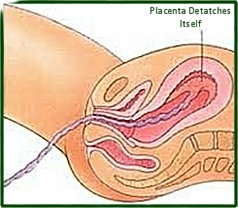 Bradley Method Stages Of Labor Chart