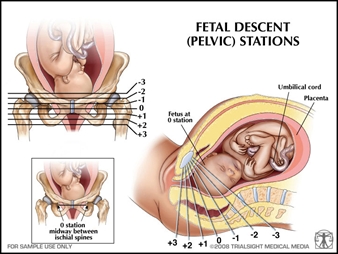 Bradley Method Stages Of Labor Chart