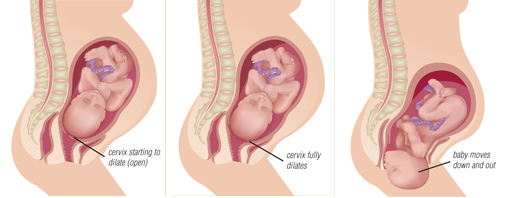 Bradley Method Stages Of Labor Chart