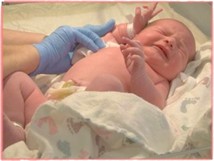 newborn-procedures