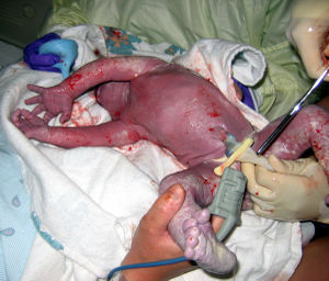 http://www.natural-parenting-advice.com/images/picture-newborn-procedures-2.jpg