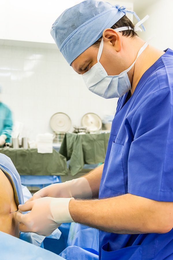 Epidural Anesthesia