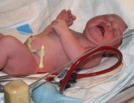 newborn procedures