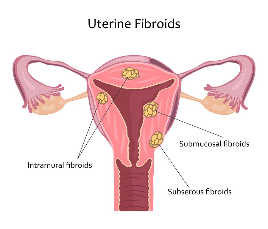 pregnancy diabetes